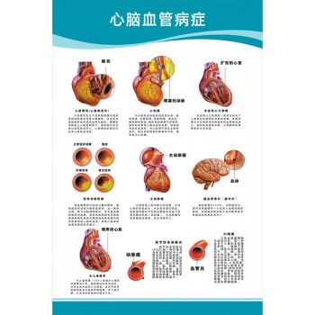 示意图大脑血液循环医学挂图心脑血管病症24寸40x60厘米pp胶背面带胶