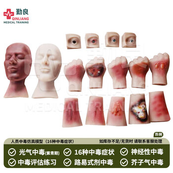 勤良伤情呈现训练模拟器材 人员中毒仿真模型 路易士气 芥子气 中毒模型 卫勤训练器材QL/C016