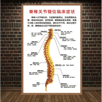 人体椎间盘常见病变颈椎脊椎息图骨骼挂图医院腰椎间盘突出墙贴 脊柱