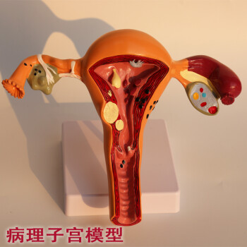 人体女性生殖子宫解剖病理模型卵巢教学模型 妇科生殖
