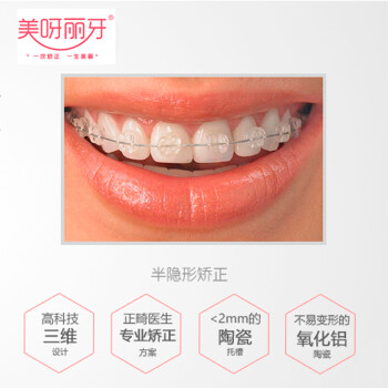 北京美呀 口腔牙齿矫正器 3D隐形\/半隐形牙齿
