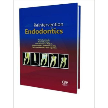 ntion in Endodontics》(Mario Luiz Zuolo,Nuolo 