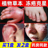 民间郎中 蛇油膏冻疮膏肿消止痒手脚防冻伤膏修复耳朵脸部儿童宝宝