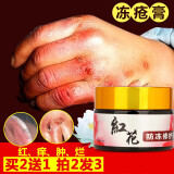 冻疮专用消肿止痒去手脚耳朵脸冻伤防冻霜瘙痒烂出血粗糙脱皮皲裂膏