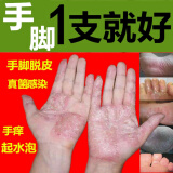 水泡手癣膏脱皮干裂真菌湿痒感染手足皮肤病止痒药膏治脚癣膏特效癣