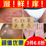 民间郎中【苗藓王】顽固牛皮股膏藓癣阴囊大腿内侧皮肤瘙痒止痒非根除