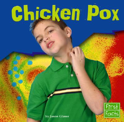 【预订】chicken pox