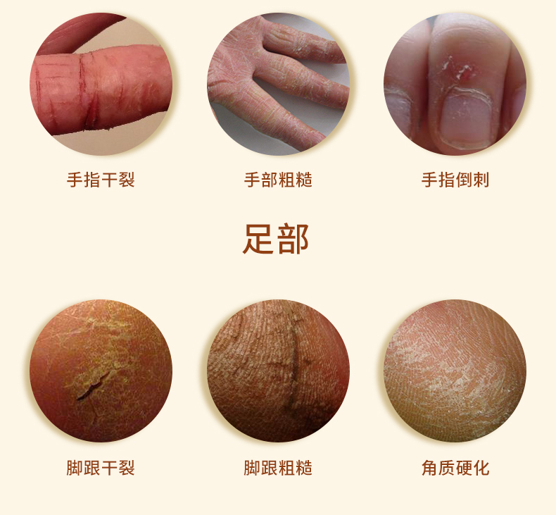 隆力奇 三效防护蛇油膏防冻防裂男女士护肤 秋冬锁水保湿防干燥脱屑 1盒
