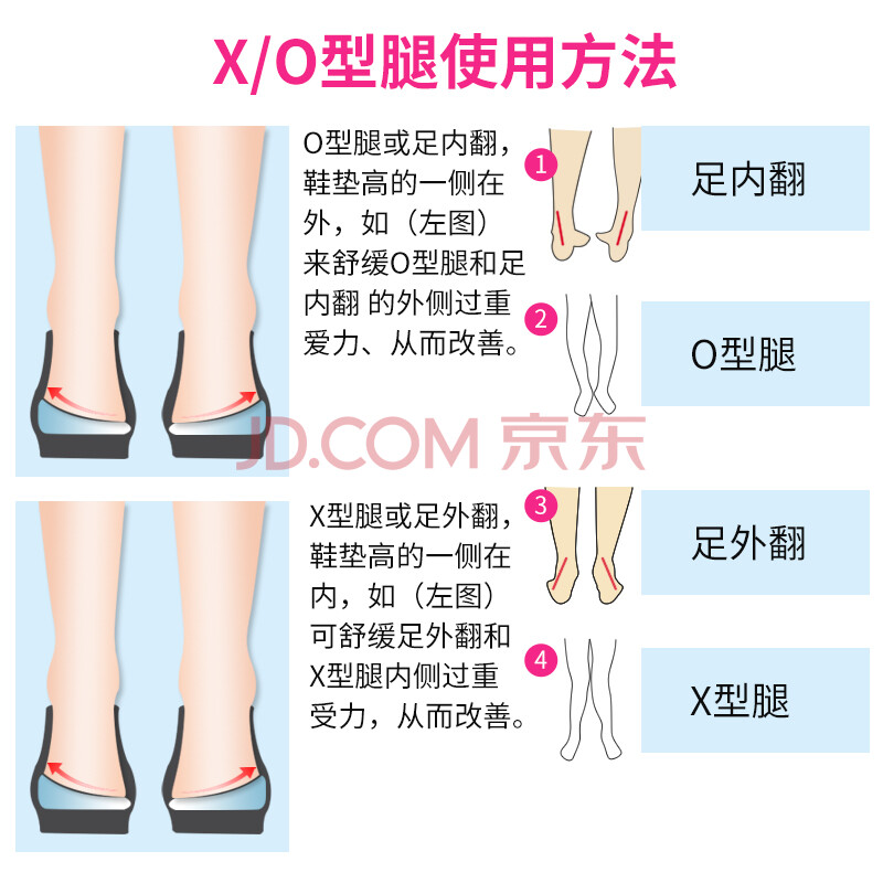 警惕寶寶足外翻 千萬不要因為自己的大意對寶寶造成永久的影響 M頭條