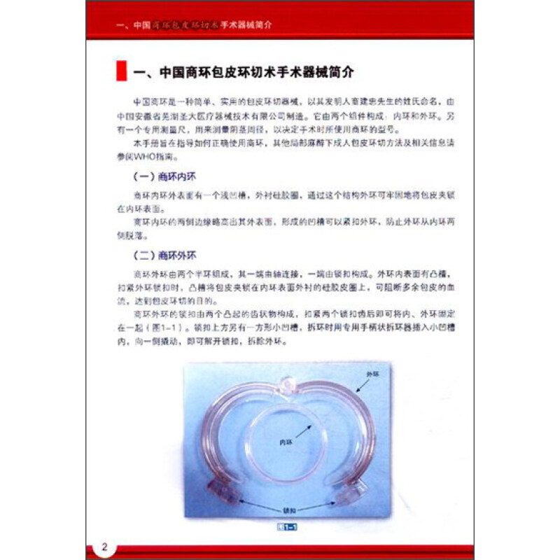 商环包皮环切术