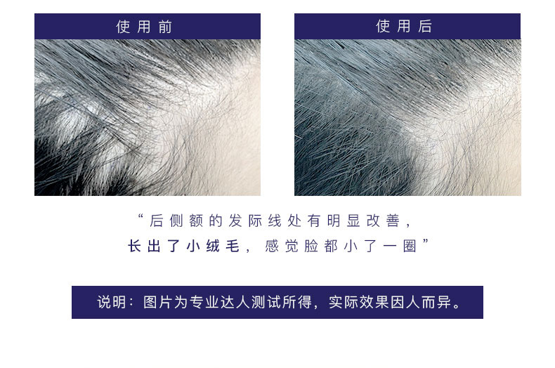 2019-5-20-洗护套装详情790_10.jpg