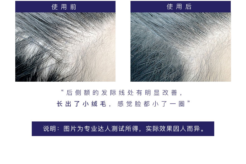 2019-5-20-强韧养发护发素描述790pxl_11.jpg