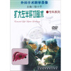 

扩大左半肝切除术DVD