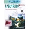 

前入路右半肝切除术DVD
