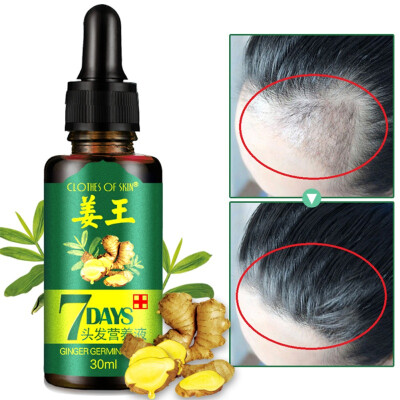 

7 Days Ginger Essence Hairdressing Hairs Mask Hair Essential Oil Hair Care Oil Essential Oil Dry&Damaged Hairs Nutrition