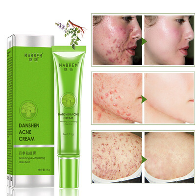 

Acne Treatment Cream Removal Face Blackhead Anti Acne Cream Oil Control Shrink Pores Acne Scar Face Whitening Care