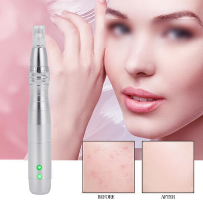 

Greensen Anti-aging 7 LED Color Light Photon Electric Derma Pen With Nano Micro Needle Derma Pen Auto Micro Needle Pen