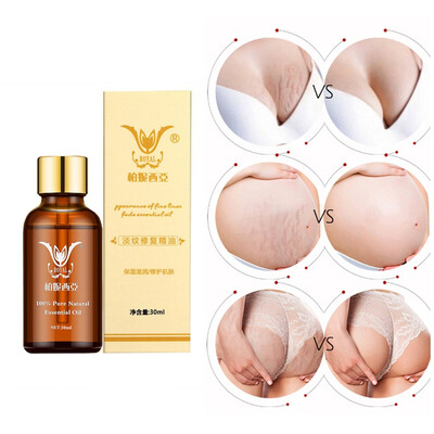 

Whitening Pregnancy Repair Oil Stretch Mark Remover Essential Oil Skin Care Treatment Nourishing Easy To Absorb