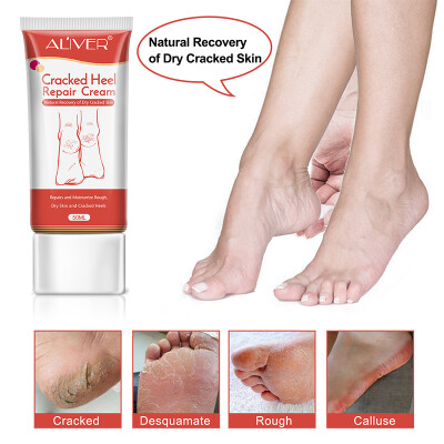 

Crack Heel Cream Repair Anti Crack Whitening Cream Foot Peeling Cracked Hands Feet Dry Skin Moisturizing Foot Care