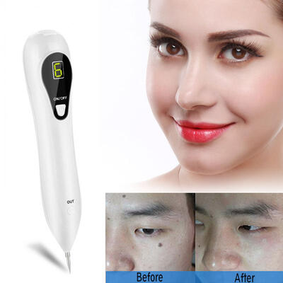 

Greensen LCD Pro Mole Freckle Removal Pen Three Levels Adjustable Spot Tattoo Remover