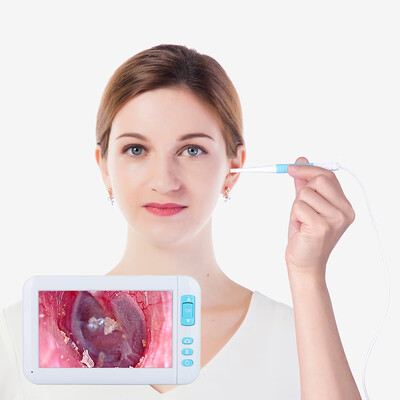 

P20 Ear Spoon Endoscope 43 Large Screen Otoscope 55mm Diameter Lens 6PCS LED 1080P HD Camera Visual Earpick Inspection Earwax