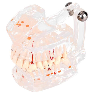 

Greensen New Dental Teaching Study Standard Tooth Model Demonstration Disease Educational Dental Supplies Dental Model