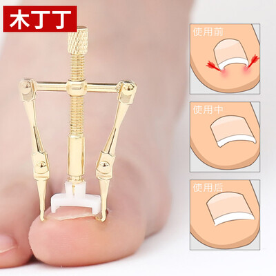 

Muding Dinging with the same paragraph of paronyitis orthodontic toe correction set ingrown correction special nail clippers nails old to the meat long pedicure set