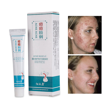 

Acne Treatment Blackhead Remova Anti Acne Cream Oil Control Shrink Pores Acne Scar Remove Face Care Whitening