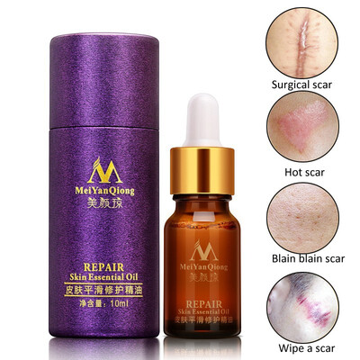 

High Quality Skin Care Repair Scar Oils Pure Lavender Remove Scar Essential Oil Natural Oils 10ML