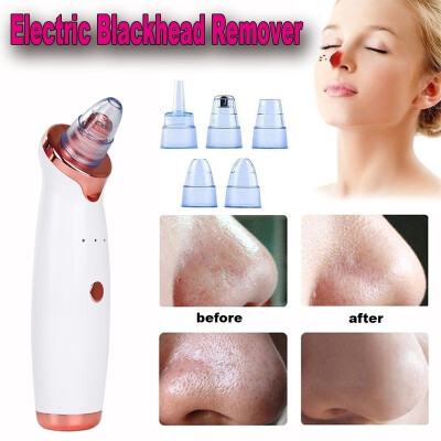 

2019 New Electric Skin Care Facial Pore Cleanser Blackhead Acne Vacuum Cleaner Remover