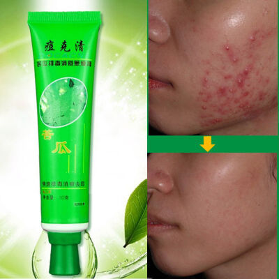 

Hot 30g Face Skin Care Acne Cream Blain Desalt Blain Imprint Face Cream New