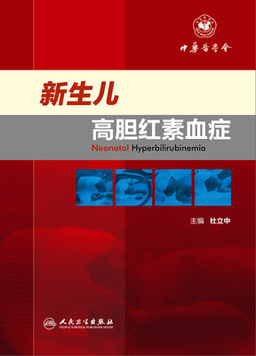 

新生儿高胆红素血症