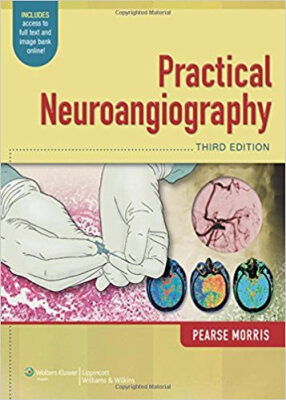 

Practical Neuroangiography