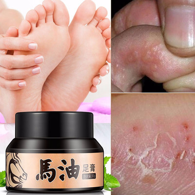 

Higo Horse Oil Feet Cream Anti-chapping Peeling off To Be Whitening Skin Repairing Foot Roughly Skin Health Care 30g