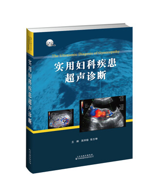 

实用妇科疾患超声诊断
