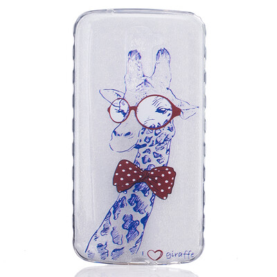 

Giraffe Pattern Soft Thin TPU Rubber Silicone Gel Case Cover for LG K10