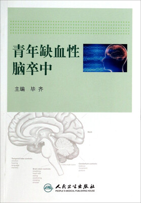 

青年缺血性脑卒中