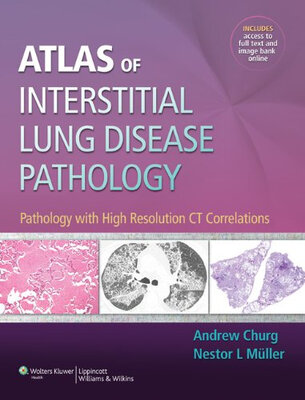

Atlas of Interstitial Lung Disease Pathology