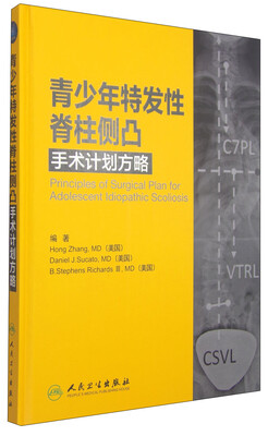 

青少年特发性脊柱侧凸手术计划方略