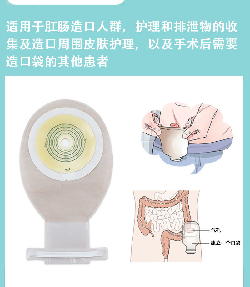 一体式造口袋直肠癌粪袋腰带式一件式造口袋造瘘大便袋扎带款造口袋3