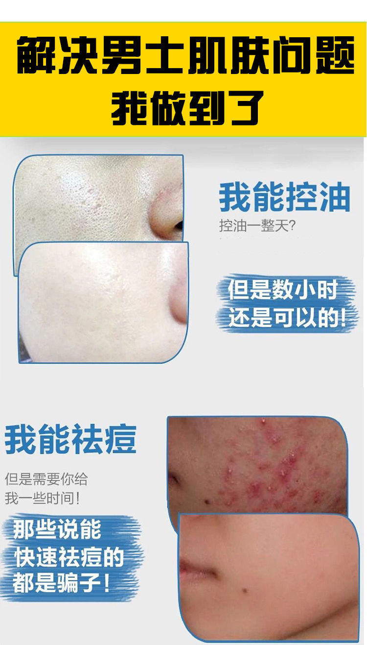 补水保湿洁面乳祛痘去黑头学生护肤品套装买一曾一款控油祛痘控油祛痘