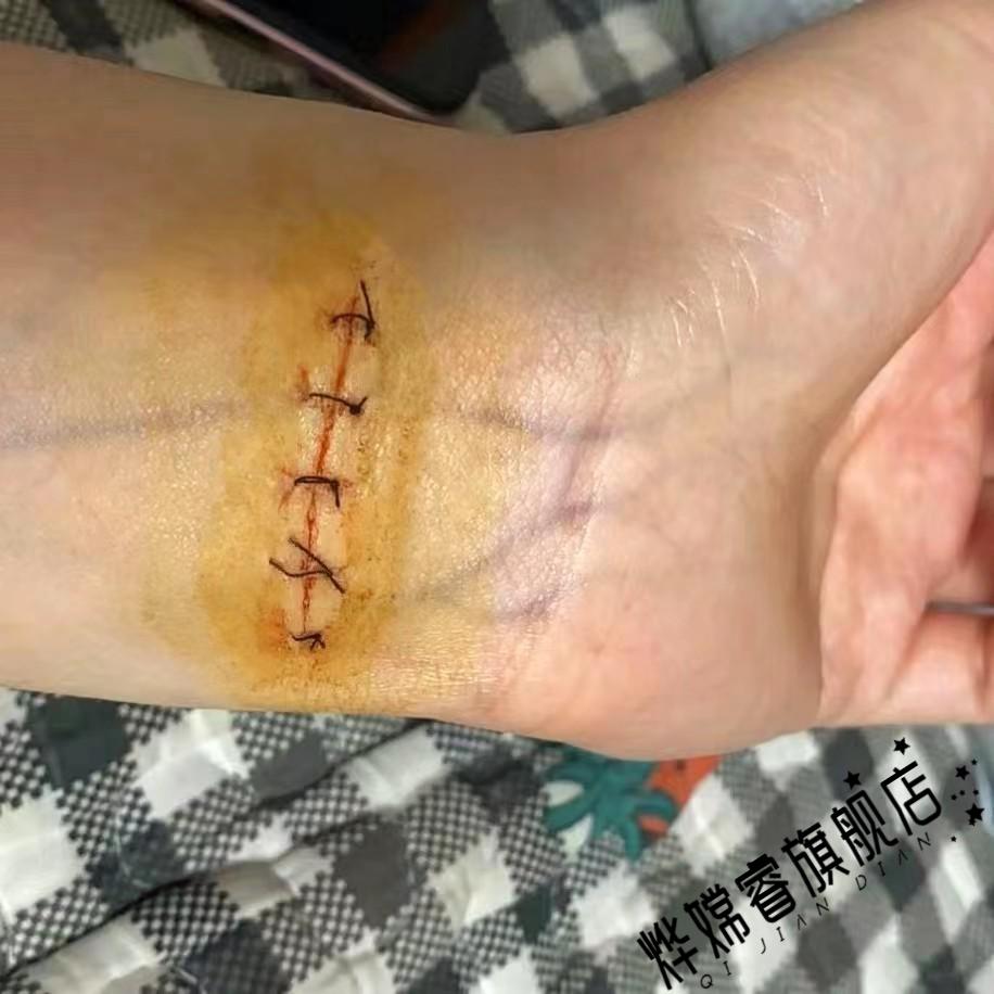 伤疤仿真贴假伤口影视整蛊道具剧组假皮手术后缝针拆线伤疤贴 3厘米