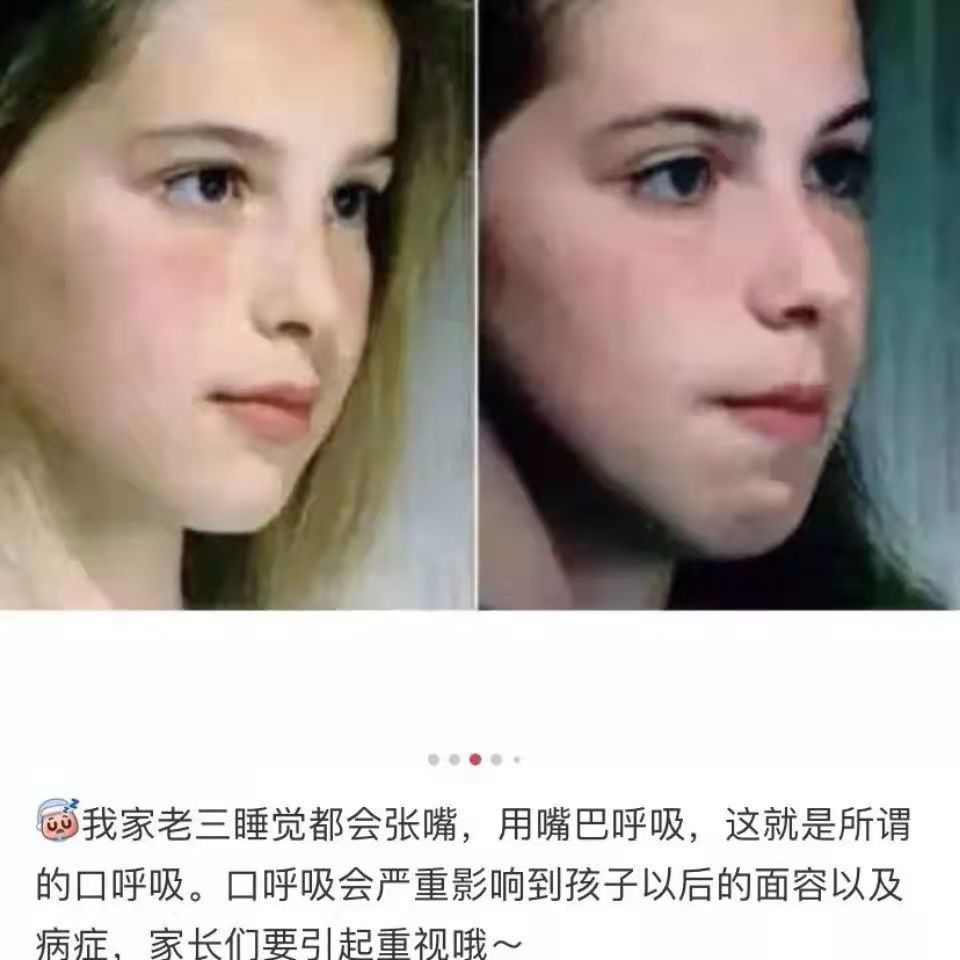 妙语诺口封嘴闭口贴防止嘴巴呼吸闭嘴神器睡觉防张嘴睡眠唇贴5包150片