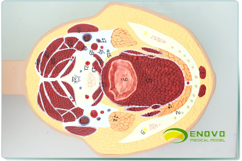 enovo颐诺医学人体头颅脑横切模型大脑模型头颅横切面断层水平切模型