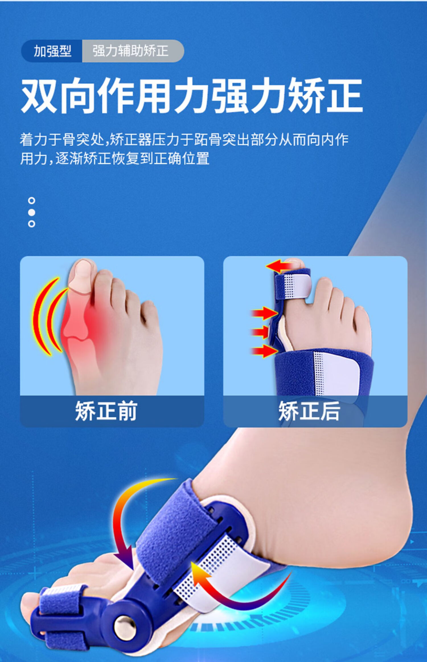 京健康脚大母脚趾大趾防磨脚指头夹脚指大拇指分离工具骨外翻矫正器女