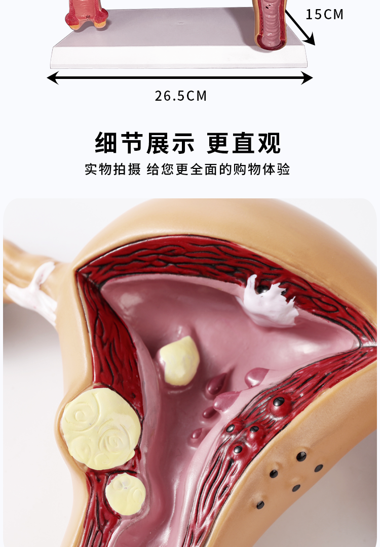 人体子宫教学模型阴道病理卵巢附件教具解剖医学女性仿真生殖模器