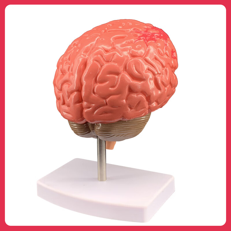 人体大脑模型脑血管模型脑解剖模型医学脑颅头教学模型可拆分8件大脑8