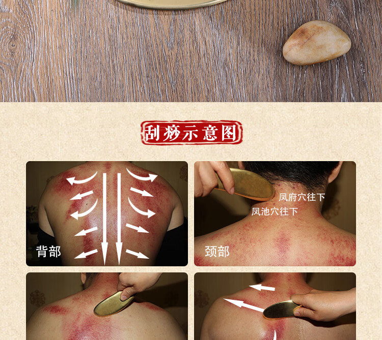【京健康】问痧堂纯黄铜刮痧板虎符砭纯铜李道政李氏砭法全身通用铜