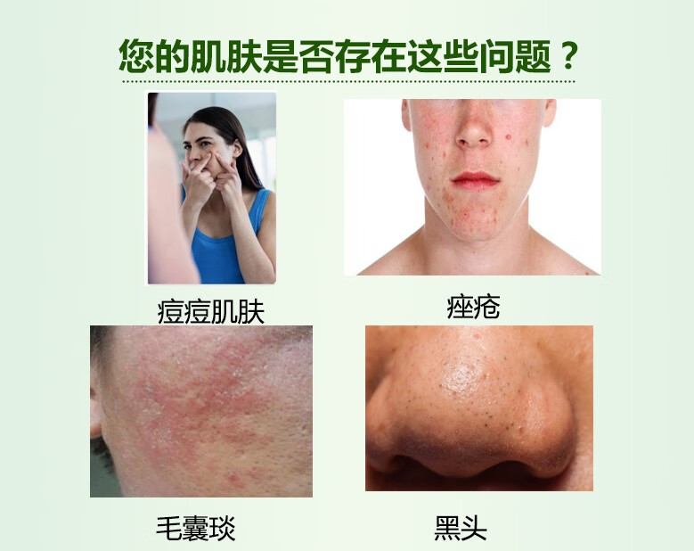 100ml复方氯霉素酒精溶液洗液氯霉素酊氯柳酊水氯酊擦剂【图片 价格