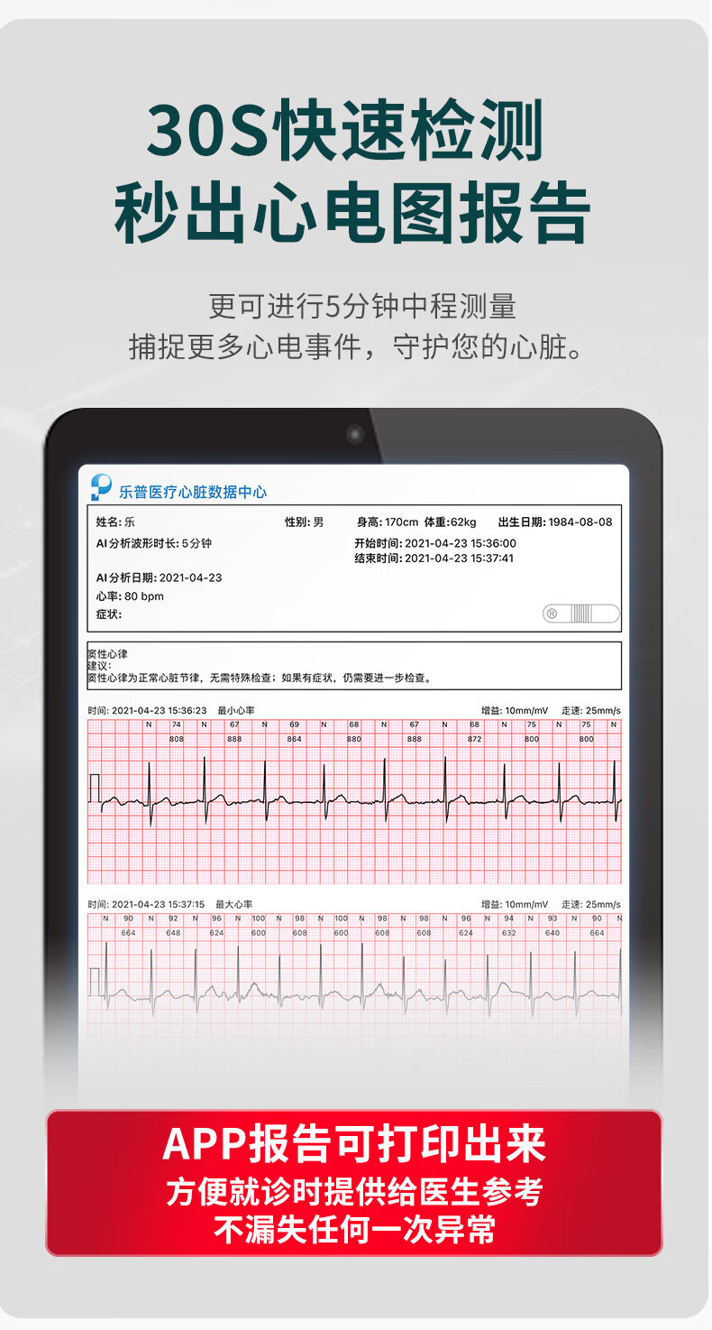 心电监护仪心率怎么看图片